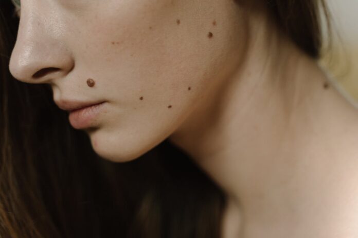 tâche sur le visage
